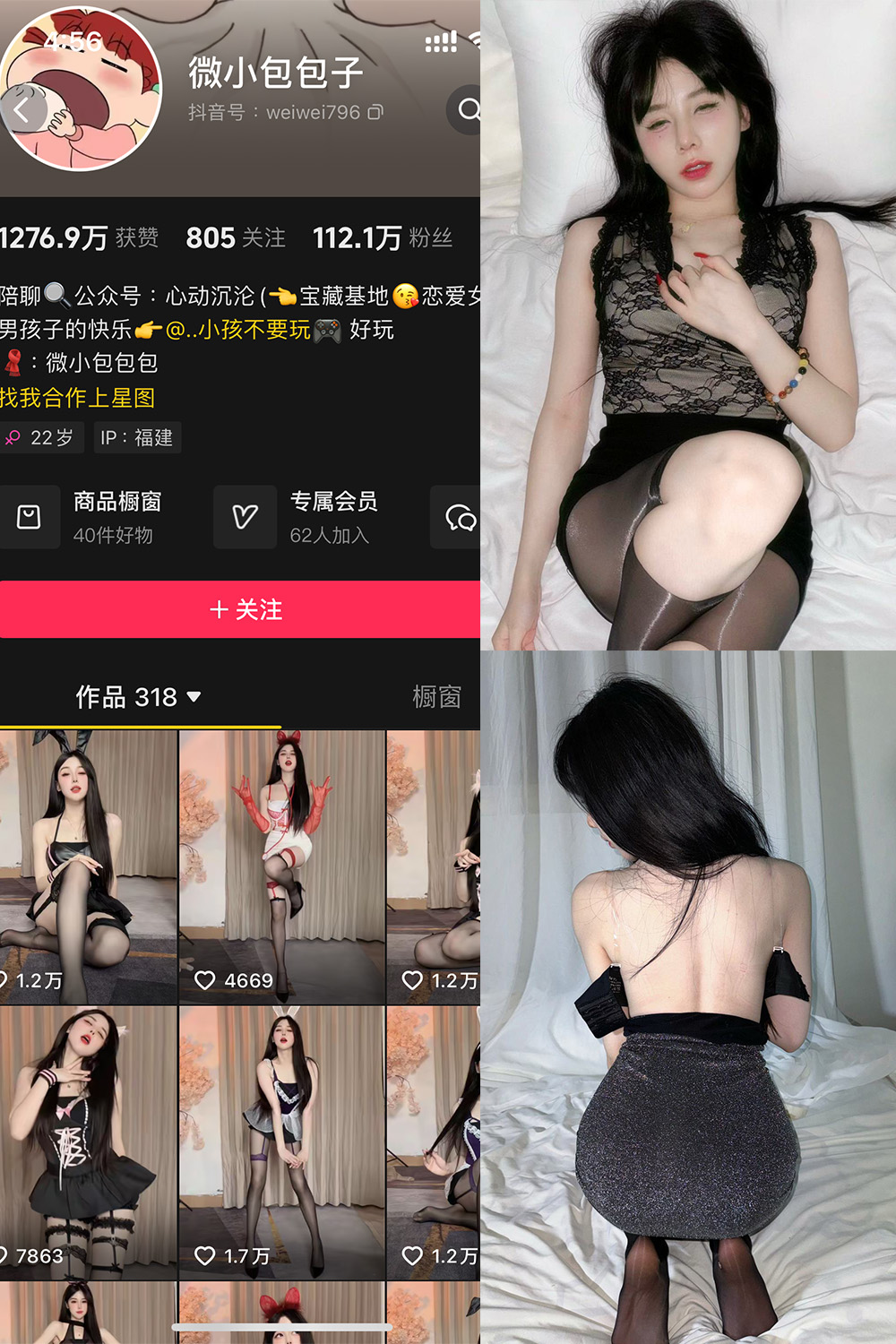 抖音 微小包包子 微密圈 NO.006期 【40P5V】最新至:
