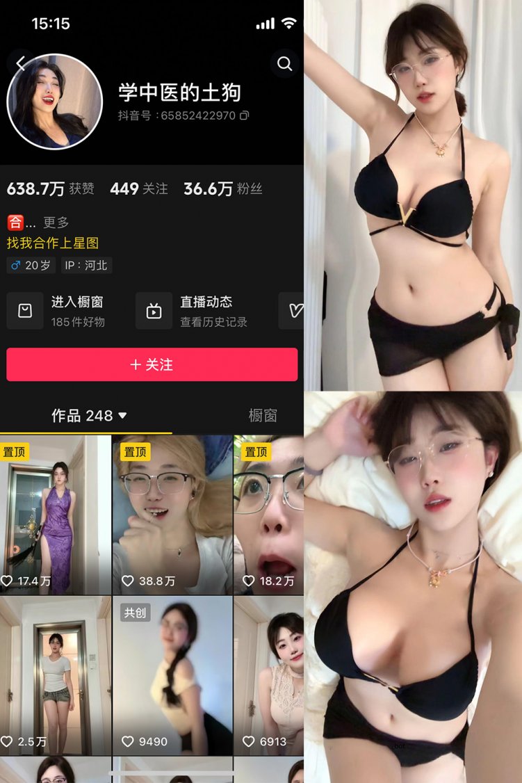 抖音 学中医的土狗 微密圈 NO.002期 【11P1V】最新