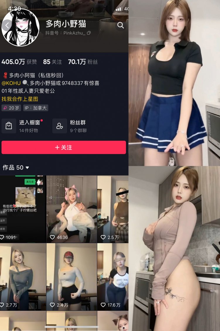 抖音 多肉小野猫 微密圈 NO.037期 【5V1P】