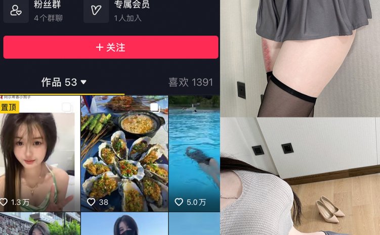 抖音 阿尔卑香小狗子 微密圈 NO.001期 【23P1V】