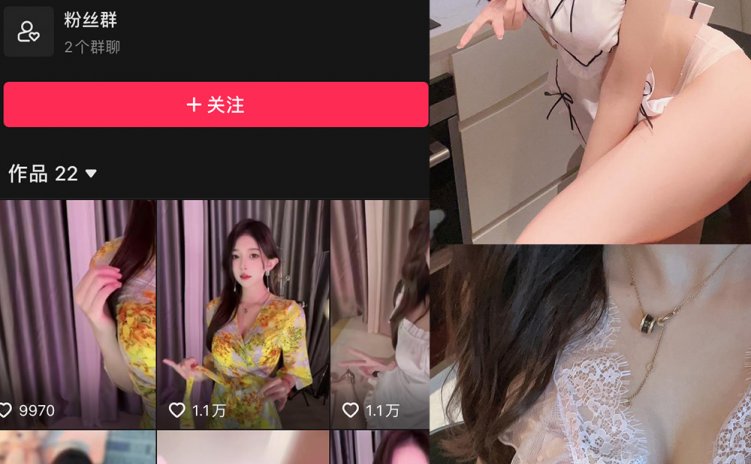 抖音 小小奶瓶儿 微密圈 NO.007期 【6P】