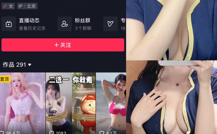 抖音 夏又米 微密圈 NO.005期 【6P】