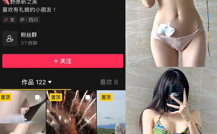 抖音 野原新之皮卡丘 微密圈 NO.005期 【82P16V】