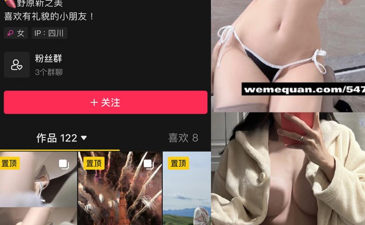 抖音 野原新之皮卡丘 微密圈 NO.007期 【95P4V】