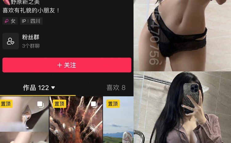 抖音 野原新之皮卡丘 微密圈 NO.008期 【61P19V】
