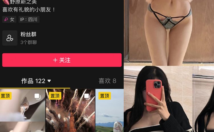 抖音 野原新之皮卡丘 微密圈 NO.009期 【100P7V】
