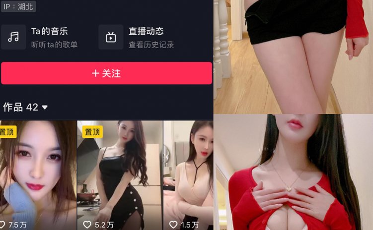 抖音 夏天的小雪 微密圈 嘉宾专享 NO.015期 【24P】最新至:2024.6.9