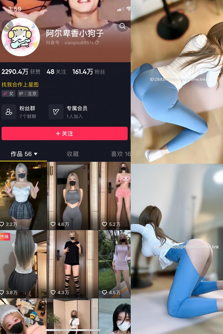 抖音 阿尔卑香小狗子 微密圈 NO.053期 【34P】