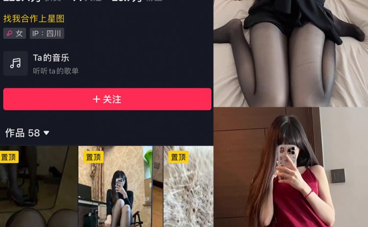 抖音 辛普森的兔子 微密圈 NO.058期 【7P9V】