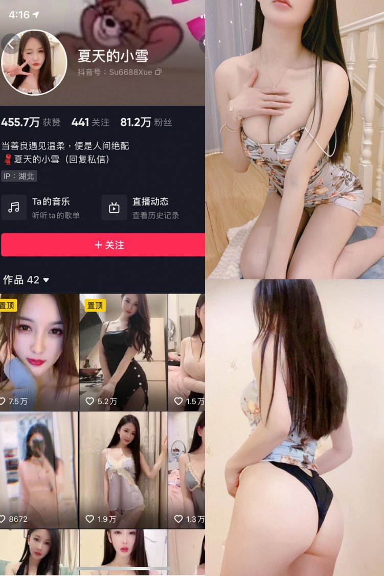 抖音 夏天的小雪 微密圈 嘉宾专享 NO.018期 【19P】
