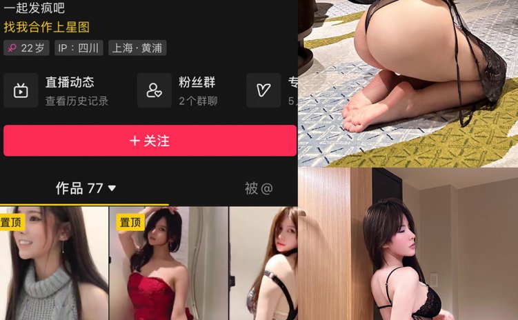 抖音 奔跑的晶骡子 微密圈 NO.014期 【35P】