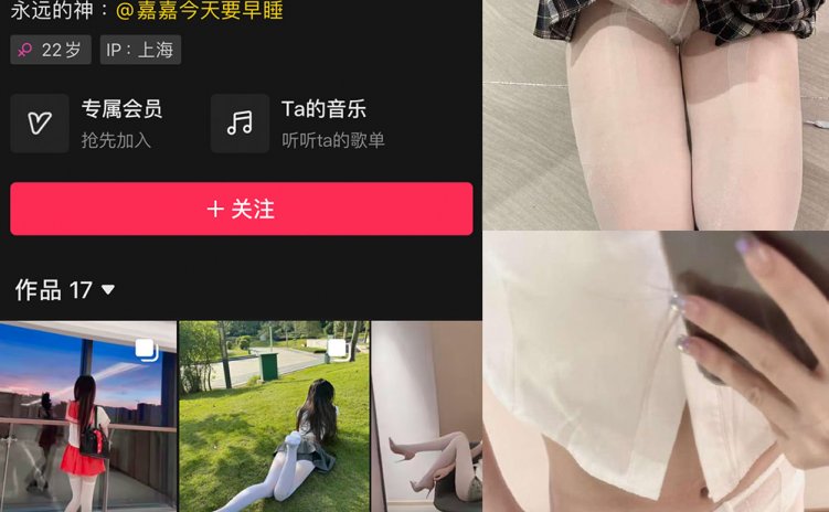 抖音 叫我可爱嘉 微密圈 NO.007期 【22P】