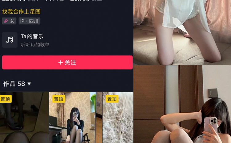 抖音 辛普森的兔子 微密圈 NO.061期 【7P18V】