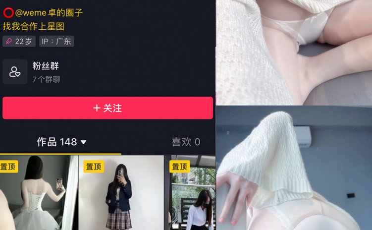 抖音 卓 微密圈 NO.015期 【37P】
