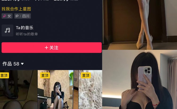 抖音 辛普森的兔子 微密圈 NO.062期 【11P17V】