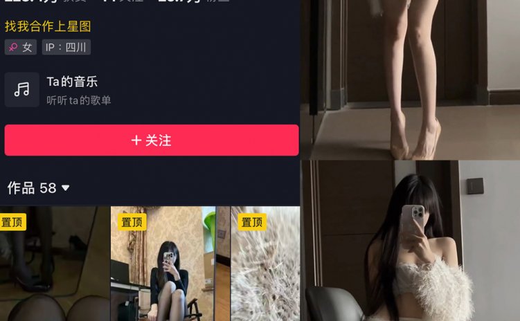 抖音 辛普森的兔子 微密圈 NO.063期 【4P9V】