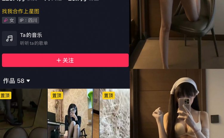 抖音 辛普森的兔子 微密圈 NO.064期 【8V】
