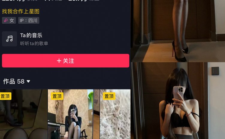 抖音 辛普森的兔子 微密圈 NO.065期 【9P11V】