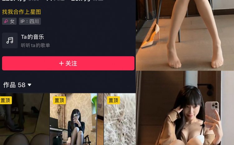 抖音 辛普森的兔子 微密圈 NO.075期 【9P3V】